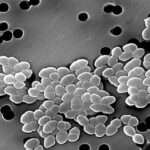 Infecciones por enterococos