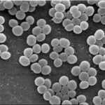 Infecciones causadas por estafilococos coagulasa-negativos