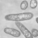 Infección por Bordetella pertussis (tos ferina)