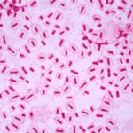 Infecciones causadas por especies de Haemophilus