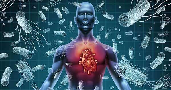 Endocarditis infecciosa