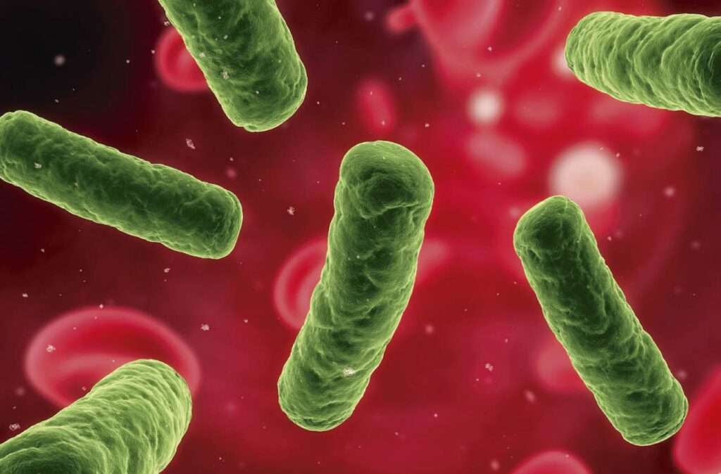 Complicaciones de la bacteremia por Salmonella