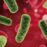 Complicaciones de la bacteremia por Salmonella