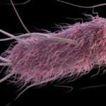 Gastroenteritis causada por Escherichia coli