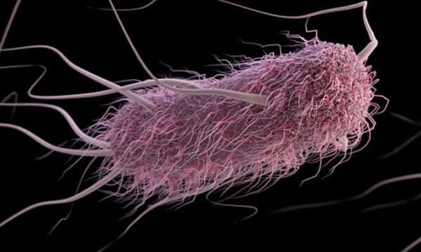 Gastroenteritis causada por Escherichia coli