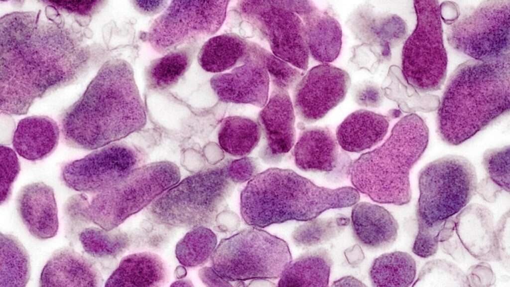 Infecciones por Mycoplasma genitalium