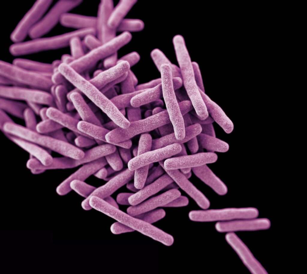 Enfermedades por micobacterias no tuberculosas