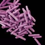 Enfermedades por micobacterias no tuberculosas