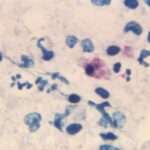 Chlamydia psittaci & psittacosis (ornitósis)