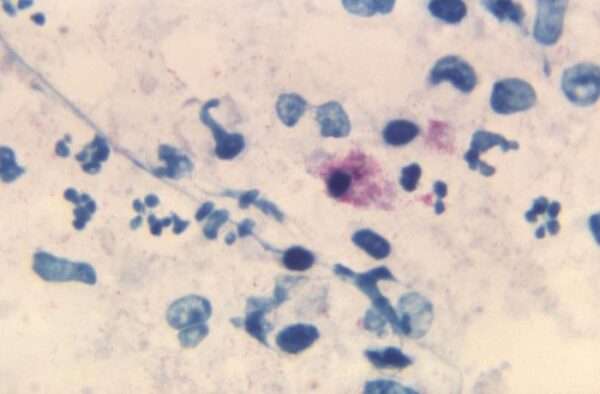 Chlamydia psittaci & psittacosis (ornitósis)