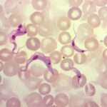 Trypanosomiasis americana (Enfermedad de Chagas)