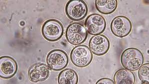 COCCIDIOSIS (Criptosporidiosis, Isosporiasis, Ciclospora, Sarcocistosis) & MICROSPORIDIOSIS