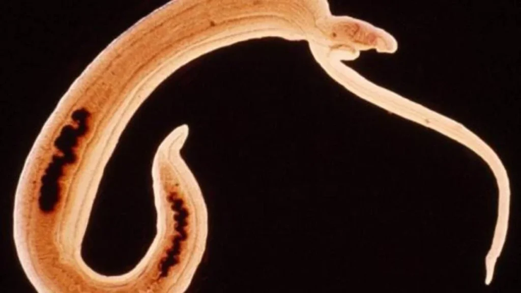 Esquistosomiasis (Bilharziasis)