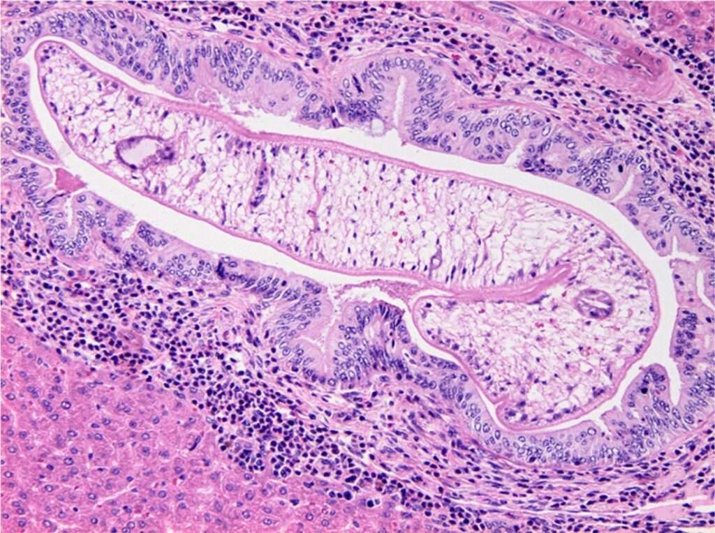 Clonorquiasis y Opistorquiasis