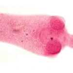 Infecciones de céstodos no invasivas