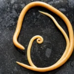 Ascaris lumbricoides