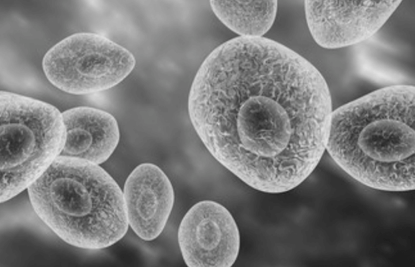 Neumocistosis (neumonía por Pneumocystis jirovecii)