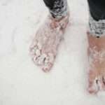 Hipotermia de las extremidades