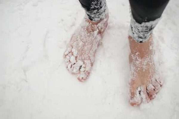 Hipotermia de las extremidades