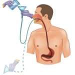 Descontaminación gastrointestinal