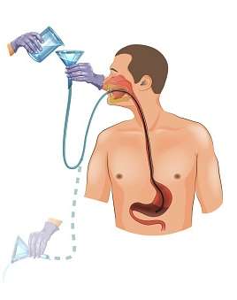 Descontaminación gastrointestinal