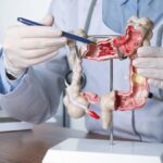 Tratamiento del cáncer colorrectal