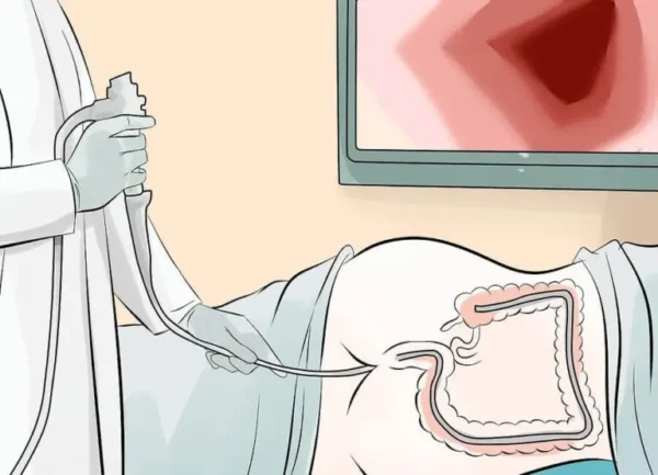 Detección de neoplasias colorrectales