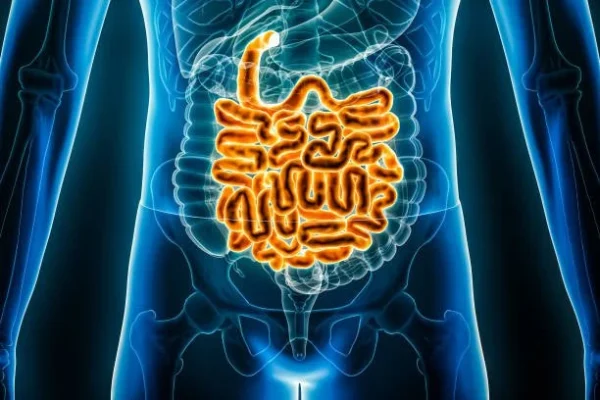 Lesiones malignas del intestino delgado