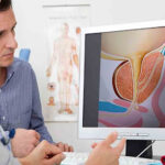 Detección del cáncer de próstata