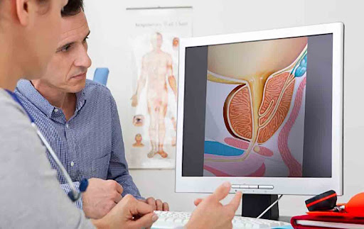 Detección del cáncer de próstata