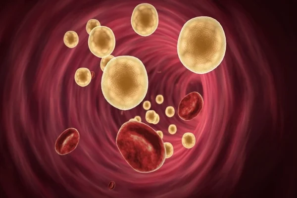 Hipercolesterolemia Familiar