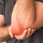 Bursitis