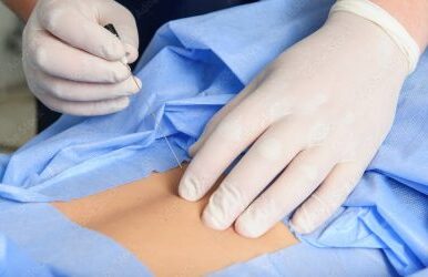 Bloqueos para cirugía de abdomen