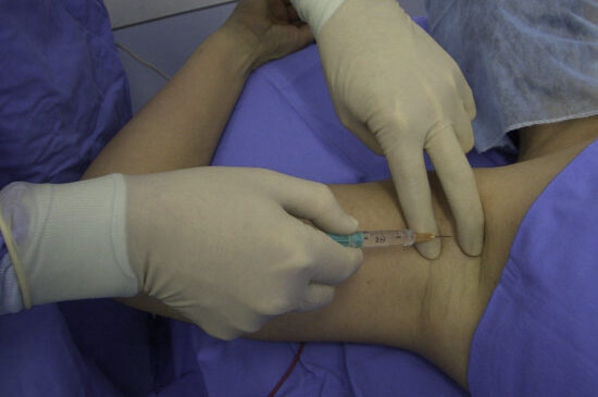 Lesión nerviosa por anestesia regional