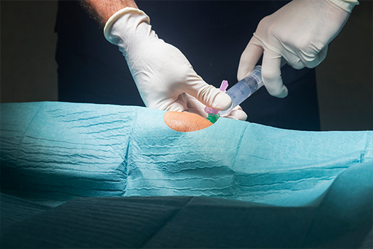 Ventajas y desventajas de la anestesia regional