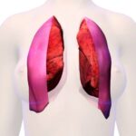 Anatomía de la pleura