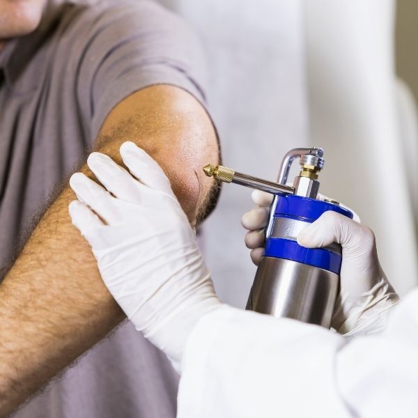 Pistola de aplicación de nitrógeno líquido para criocirugía