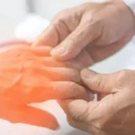 Neuropatía periférica. Evaluación y diagnóstico diferencial