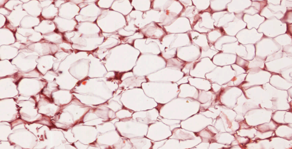 Tipos de tejido adiposo