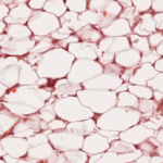 Tipos de tejido adiposo