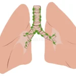 Drenaje linfático pulmonar