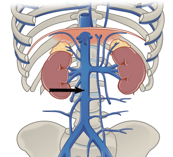 Vena cava inferior