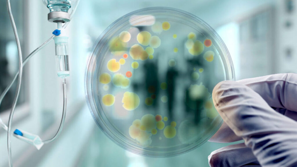 Detección y Manejo de Brotes en Microbiología Clínica