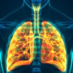 Los efectos y la patogénesis del PM2.5 y sus componentes en la EPOC