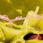 Mecanismos de la Patogénesis Bacteriana