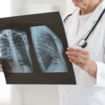 Radiografía convencional o placa simple