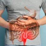 Factores de riesgo ambiental para la enfermedad inflamatoria intestinal
