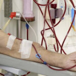 Acceso vascular en hemodiálisis