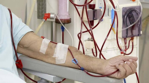 Acceso vascular en hemodiálisis