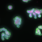 Organoides intestinales
